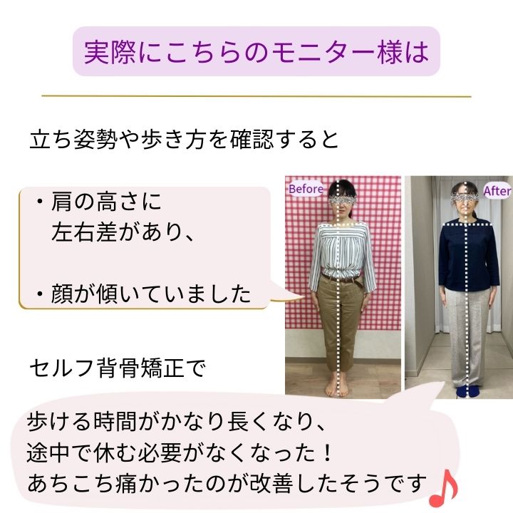 脚のしびれ改善ビフォーアフターの写真と感想